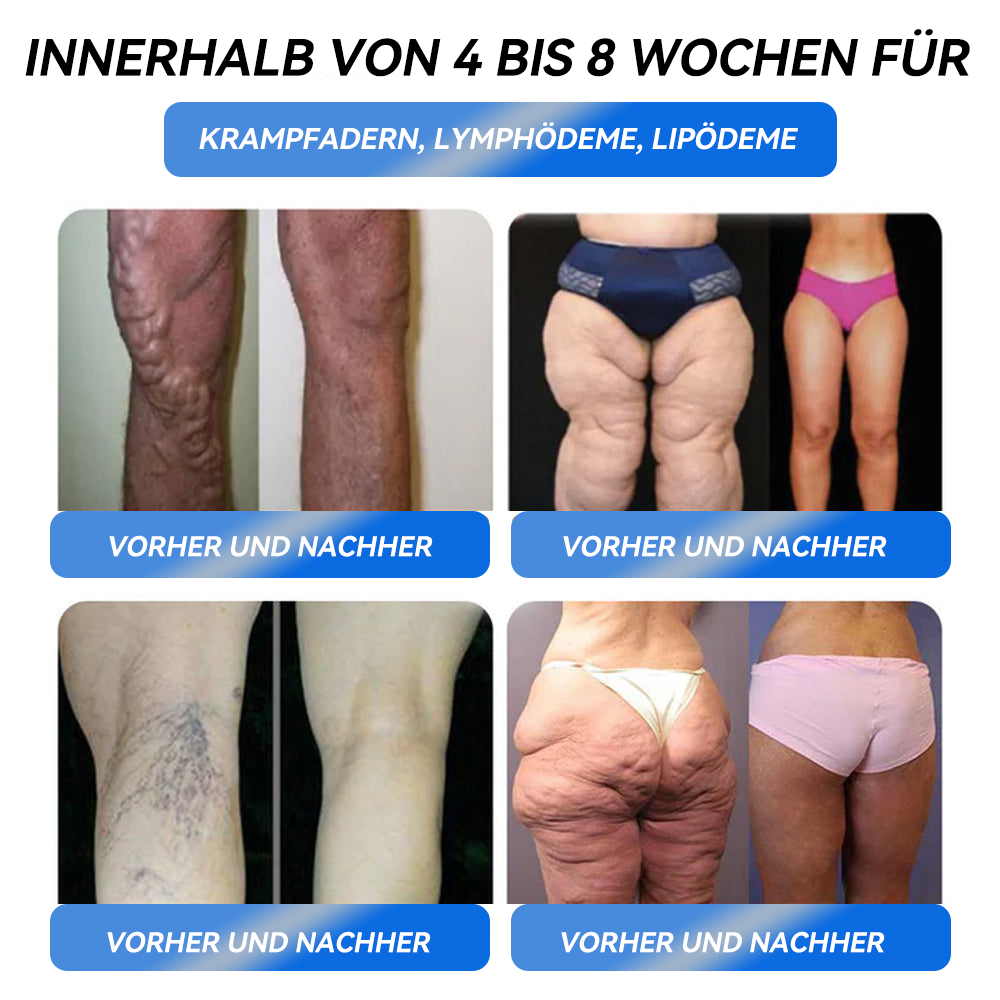 𝐈𝐅𝐌𝐀𝐆𝐈𝐂® 𝐆𝐋𝐏-𝟏 𝐏𝐫𝐨 𝐆𝐞𝐰𝐢𝐜𝐡𝐭𝐬𝐫𝐞𝐝𝐮𝐤𝐭𝐢𝐨𝐧𝐬-𝐎𝐫𝐚𝐥-𝐋ö𝐬𝐮𝐧𝐠🍁💖
