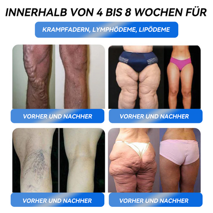 𝐈𝐅𝐌𝐀𝐆𝐈𝐂® 𝐆𝐋𝐏-𝟏 𝐏𝐫𝐨 𝐆𝐞𝐰𝐢𝐜𝐡𝐭𝐬𝐫𝐞𝐝𝐮𝐤𝐭𝐢𝐨𝐧𝐬-𝐎𝐫𝐚𝐥-𝐋ö𝐬𝐮𝐧𝐠🌴💖