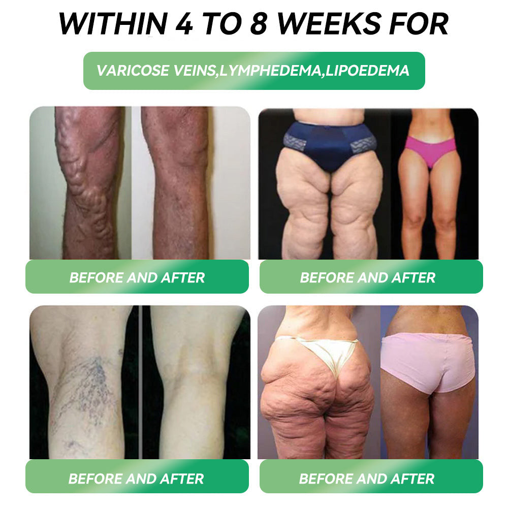 𝐒𝐓𝐃𝐄𝐈® 𝐆𝐋𝐏-𝟏 𝐎𝐫𝐚𝐥𝐞 𝐋ö𝐬𝐮𝐧𝐠 𝐳𝐮𝐫 𝐆𝐞𝐰𝐢𝐜𝐡𝐭𝐬𝐫𝐞𝐝𝐮𝐤𝐭𝐢𝐨𝐧 - 📘